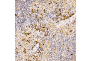 Immunohistochemistry of paraffin-embedded rat spleen using Bag1 Rabbit mAb (ABIN7265847) at dilution of 1:50 (40x lens). (BAG1 antibody)