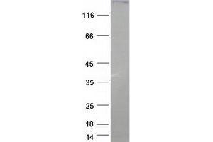 Validation with Western Blot (Peroxidasin Protein (Myc-DYKDDDDK Tag))