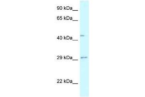 Western Blot showing FUT8 antibody used at a concentration of 1 ug/ml against Fetal Liver Lysate (FUT8 antibody  (N-Term))