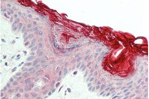 ABIN185623 (5µg/ml) staining of paraffin embedded Human Skin. (PERP antibody  (C-Term))