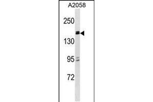 Western blot analysis in A2058 cell line lysates (35ug/lane). (ZBTB38 antibody  (N-Term))
