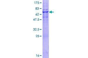 RNF150 Protein (AA 1-314) (GST tag)