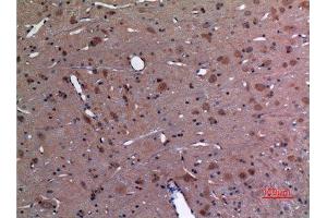 Immunohistochemistry (IHC) analysis of paraffin-embedded Rat Brain, antibody was diluted at 1:100. (UBE2A/B (C-Term) antibody)