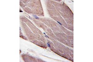 Formalin-fixed and paraffin-embedded human skeletal muscle tissue reacted with PDK4-, which was peroxidase-conjugated to the secondary antibody, followed by DAB staining. (PDK4 antibody  (AA 250-277))