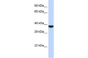 Host:  Rabbit  Target Name:  TMPPE  Sample Type:  721_B Whole cell lysates  Antibody Dilution:  1. (TMPPE antibody  (N-Term))