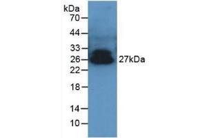 Detection of ADPN in Porcine Serum using Polyclonal Antibody to Adiponectin (ADPN) (ADIPOQ antibody  (AA 17-243))