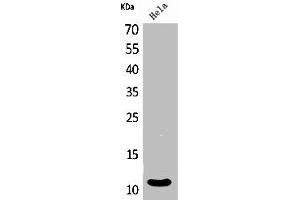 Western Blot analysis of HeLa cells using IL-8 Polyclonal Antibody (IL-8 antibody  (C-Term))