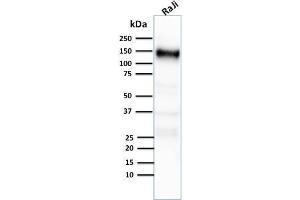 Western Blotting (WB) image for anti-Complement Component (3d/Epstein Barr Virus) Receptor 2 (CR2) (AA 142-240) antibody (ABIN6939184)