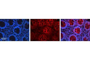 Rabbit Anti-CEBPB Antibody Catalog Number: ARP31259_P050 Formalin Fixed Paraffin Embedded Tissue: Human Appendix (Colon) Tissue Observed Staining: Cytoplasm Primary Antibody Concentration: 1:100 Other Working Concentrations: N/A Secondary Antibody: Donkey anti-Rabbit-Cy3 Secondary Antibody Concentration: 1:200 Magnification: 20X Exposure Time: 0. (CEBPB antibody  (C-Term))