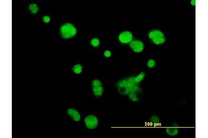 Immunofluorescence of monoclonal antibody to ATPIF1 on MCF-7 cell.