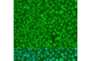 Immunofluorescence analysis of U2OS cells using CHEK1 Polyclonal Antibody at dilution of 1:100. (CHEK1 antibody)