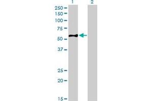 Western Blotting (WB) image for anti-Eukaryotic Translation Initiation Factor 5 (EIF5) (AA 1-432) antibody (ABIN598657) (EIF5 antibody  (AA 1-432))