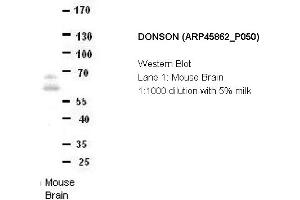 Image no. 2 for anti-Downstream Neighbor of SON (DONSON) (Middle Region) antibody (ABIN2782388) (DONSON antibody  (Middle Region))