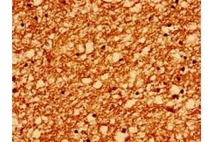 Immunohistochemistry of paraffin-embedded human brain tissue using ABIN7167523 at dilution of 1:100