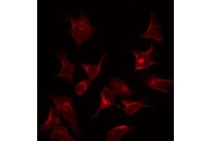 ABIN6267310 staining HeLa by IF/ICC. (PKC beta antibody  (pSer661))