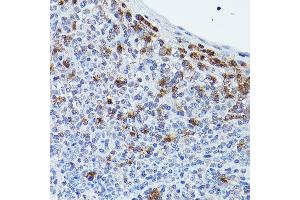 Immunohistochemistry of paraffin-embedded human tonsil using GPR109A/HM74A/HC Rabbit pAb (ABIN7267804) at dilution of 1:25 (40x lens). (HCAR2 antibody  (AA 250-350))
