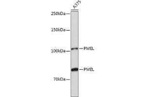 Western blot analysis of extracts of  cells, using PMEL antibody (ABIN7269510) at 1:1000 dilution. (Melanoma gp100 antibody  (AA 25-300))