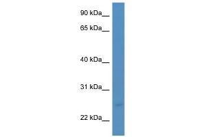 WB Suggested Anti-MANF Antibody Titration: 0. (MANF antibody  (C-Term))