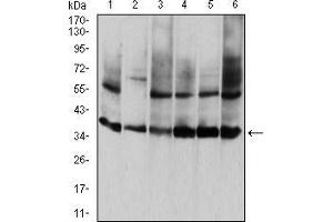 Western blot analysis using ANXA5 mouse mAb against HepG2 (1), PNAC-1 (2), NIH/3T3 (3), Hela (4), MCF-7 (5), and A431 (6) cell lysate.