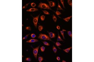 Immunofluorescence analysis of L929 cells using SC antibody (ABIN7270188) at dilution of 1:100. (SCAMP2 antibody  (AA 1-152))