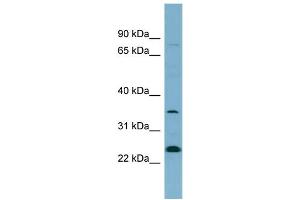 WB Suggested Anti-NOSIP  Antibody Titration: 0.