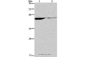Western blot analysis of Human paraneoplastic and normal kidney tissue, using KCNK9 Polyclonal Antibody at dilution of 1:650