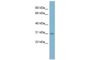 WB Suggested Anti-SCO1 Antibody Titration: 0. (SCO1 antibody  (Middle Region))