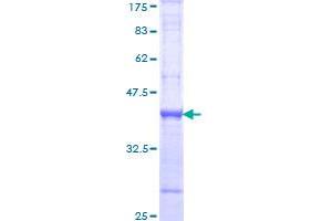 BMP1 Protein (AA 747-845) (GST tag)