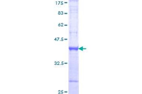 BMP1 Protein (AA 747-845) (GST tag)