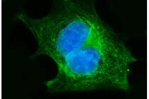 IF analysis of FGFR3 using anti-FGFR3 antibody (ABIN7603047). (FGFR3 antibody  (Middle Region))