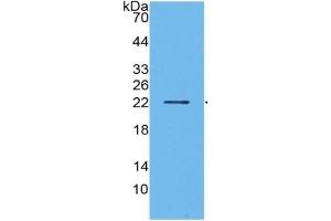 WB of Protein Standard: different control antibodies  against Highly purified E. (IL1A ELISA Kit)