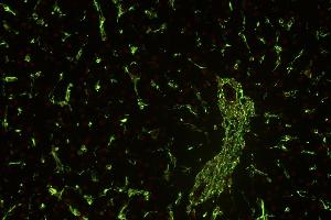 Immunohistochemistry staining (paraffin sections) of vimentin in human liver using mouse monoclonal antibody VI-01 ((ABIN94491), diluted 1:400), detected with GAM IgM-Alexa Fluor488 (diluted 1:200, green), cell nuclei stained with PI (1 μg/mL, orange). (Vimentin antibody)
