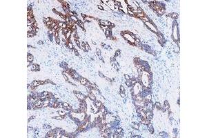 IHC analysis of Cytokeratin 8/KRT8 using anti-Cytokeratin 8/KRT8 antibody (ABIN5518853). (KRT8 antibody  (AA 107-325))