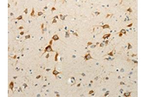 The image on the left is immunohistochemistry of paraffin-embedded Human brain tissue using ABIN7130917(RPAP3 Antibody) at dilution 1/15, on the right is treated with fusion protein. (RPAP3 antibody)