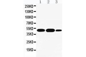 Anti-INDOL1 antibody, Western blotting Lane 1: A549 Cell Lysate Lane 2: Human Placenta Tissue Lysate Lane 3: A431 Cell Lysate (IDO2 antibody  (N-Term))