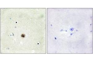 Immunohistochemistry analysis of paraffin-embedded human brain tissue, using CRP1 Antibody. (CSRP1 antibody  (AA 51-100))