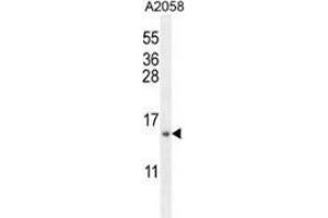 Western blot analysis in A2058 cell line lysates (35ug/lane) using MRPS24 Antibody . (MRPS24 antibody  (Middle Region))