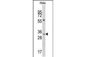 Western blot analysis of anti-MAGEA1 Antibody in Hela cell line lysates (35ug/lane). (MAGEA1 antibody  (AA 143-173))