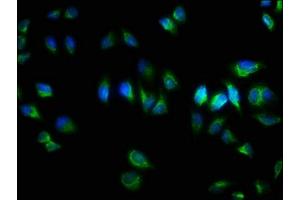 Immunofluorescence staining of Hela cells with  at 1:333, counter-stained with DAPI. (TNRC6A antibody  (AA 1-161))