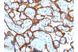 Formalin-fixed, paraffin-embedded human Placenta stained with CD71 Mouse Monoclonal Antibody (TFRC/1817).