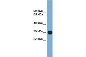 WB Suggested Anti-EIF4E2  Antibody Titration: 0.