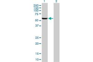 Western Blot analysis of GHDC expression in transfected 293T cell line by GHDC MaxPab polyclonal antibody.