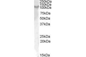 ABIN570920 (1µg/ml) staining of Rat Kidney lysate (35µg protein in RIPA buffer). (IL17RA antibody  (Internal Region))