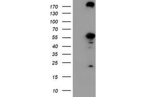HEK293T cells were transfected with the pCMV6-ENTRY control (Left lane) or pCMV6-ENTRY CNDP2 (Right lane) cDNA for 48 hrs and lysed. (CNDP2 antibody)