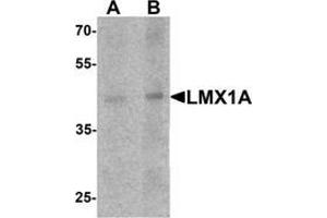Western blot analysis of LMX1A in rat brain tissue lysaet with LMX1A Antibody  at (A) 1 and (B) 2 μg/ml. (LMX1A antibody  (C-Term))