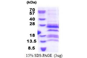 G Antigen 12F (GAGE12F) (AA 1-117) protein (His tag)