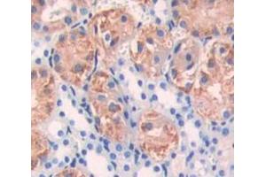 Used in DAB staining on fromalin fixed paraffin- embedded Kidney tissue (DGKG antibody  (AA 346-576))