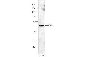 Lane 1:Rat brain lysates probed with Rabbit Anti-KCNK3 Polyclonal Antibody, Unconjugated  at 1:3000 for 90 min at 37˚C. (KCNK3 antibody  (AA 181-280))