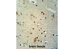 CIC antibody (N-term) immunohistochemistry analysis in formalin fixed and paraffin embedded human brain tissue followed by peroxidase conjugation of the secondary antibody and DAB staining. (CIC antibody  (N-Term))