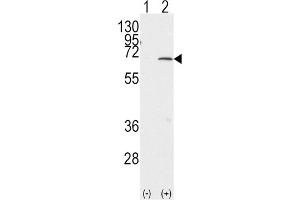 Western Blotting (WB) image for anti-Protein Inhibitor of Activated STAT, 1 (PIAS1) antibody (ABIN2996746)